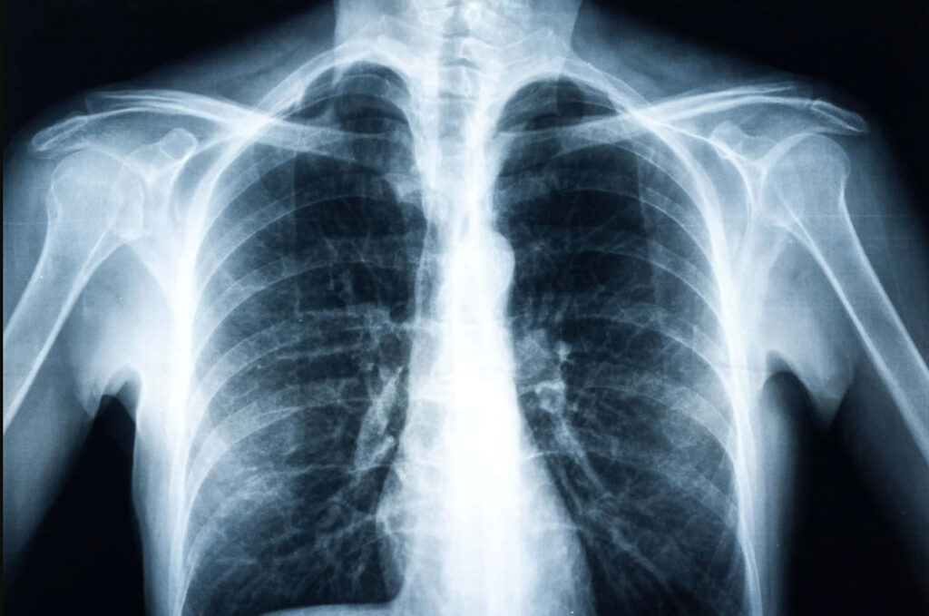 digital x-ray centres near canal road dehradun